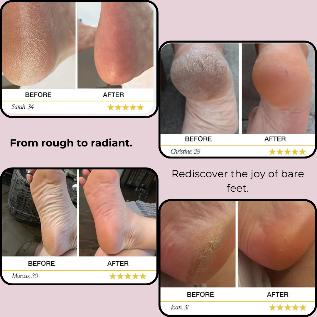 SmoothStride: Your Path to Flawless Feet