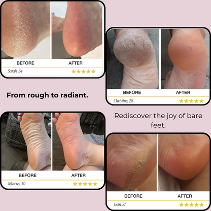 SmoothStride: Your Path to Flawless Feet